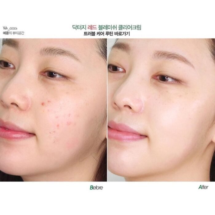 ⁦Dr.G R.E.D Blemish Clear Soothing Cream - 70ml⁩ - الصورة ⁦2⁩