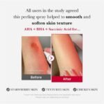 ⁦Medicube RED ACNE BODY PEELING SHOT 2.0 - 110g⁩ - الصورة ⁦3⁩