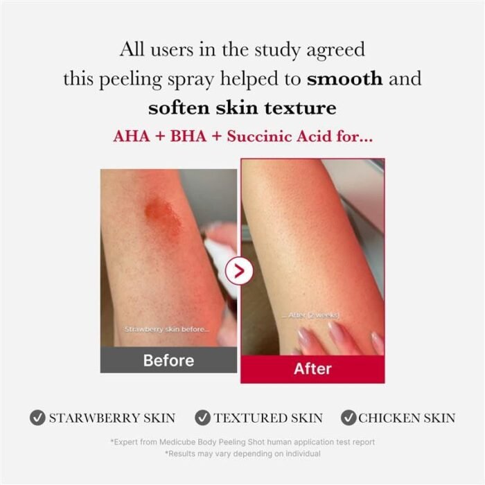 ⁦Medicube RED ACNE BODY PEELING SHOT 2.0 - 110g⁩ - الصورة ⁦3⁩
